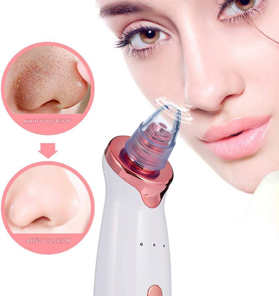 Aspirateur de points noirs "Multifunctional Cleaning Instrument" - Ethni Beauty Market - Ethni Beauty Market