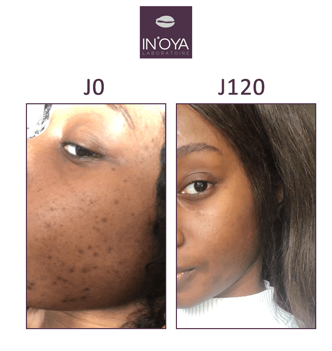 IN'OYA - Mon Sérum peaux noires & mates "anti-tâches" - 30mL - In'oya - Ethni Beauty Market